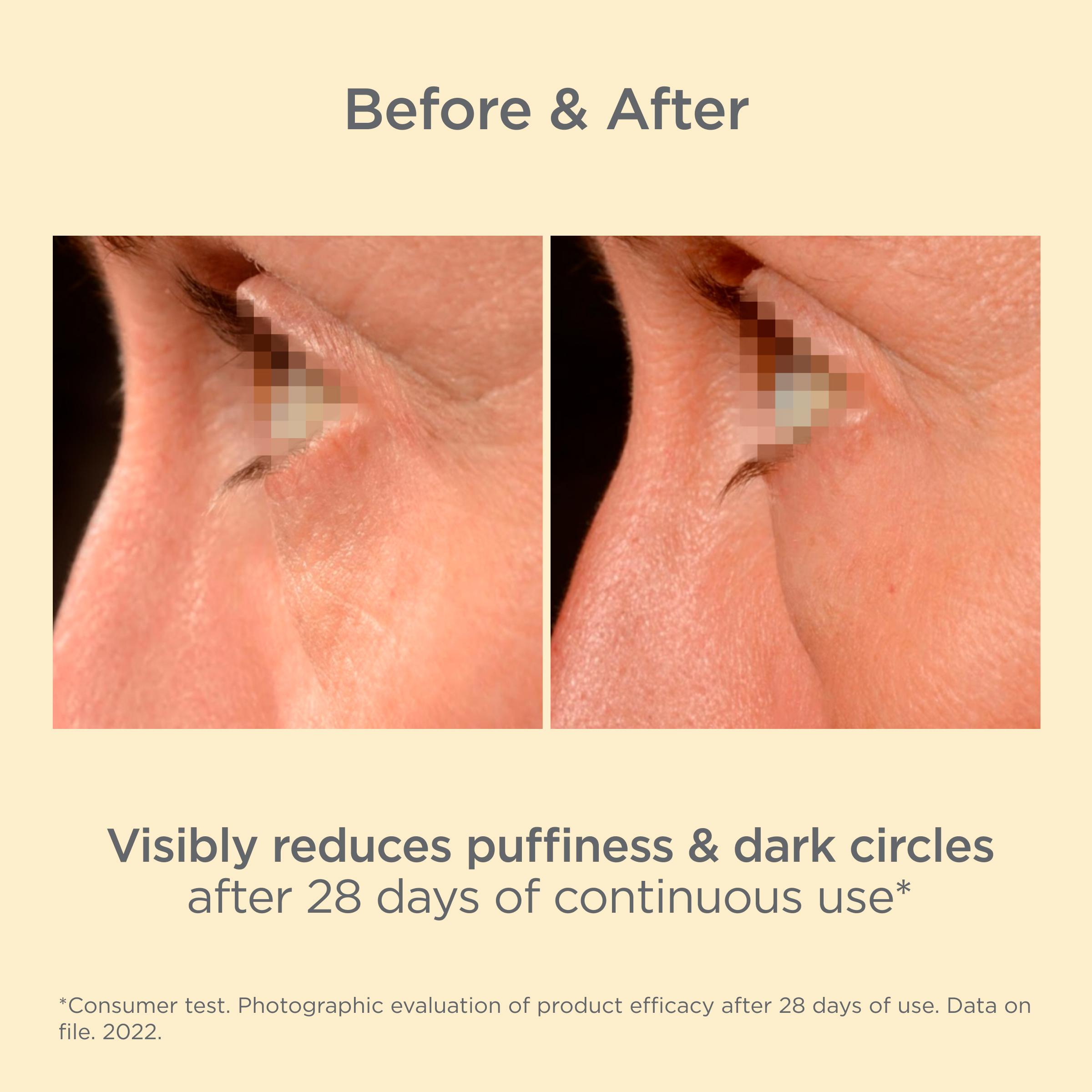 K-Ox Eyes® - Image 9